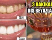 Diş Hekimleri Bunun Bilinmesini İstemiyor, Diş Beyazlatmak İçin Yöntem